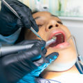 A Brighter, Safer Smile: The Role Of Personal Protective Equipment In Teeth Whitening Services In Manassas Park